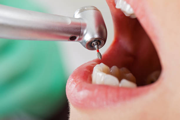 Best Emergency Dentist for Knocked-Out Tooth in Battle Creek, MI